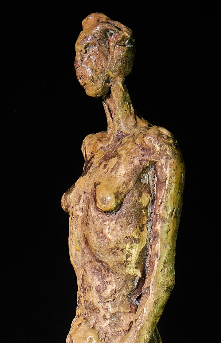 Anorexic woman